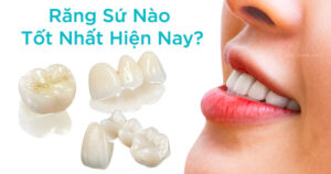 Răng sứ nào tốt nhất hiện nay?