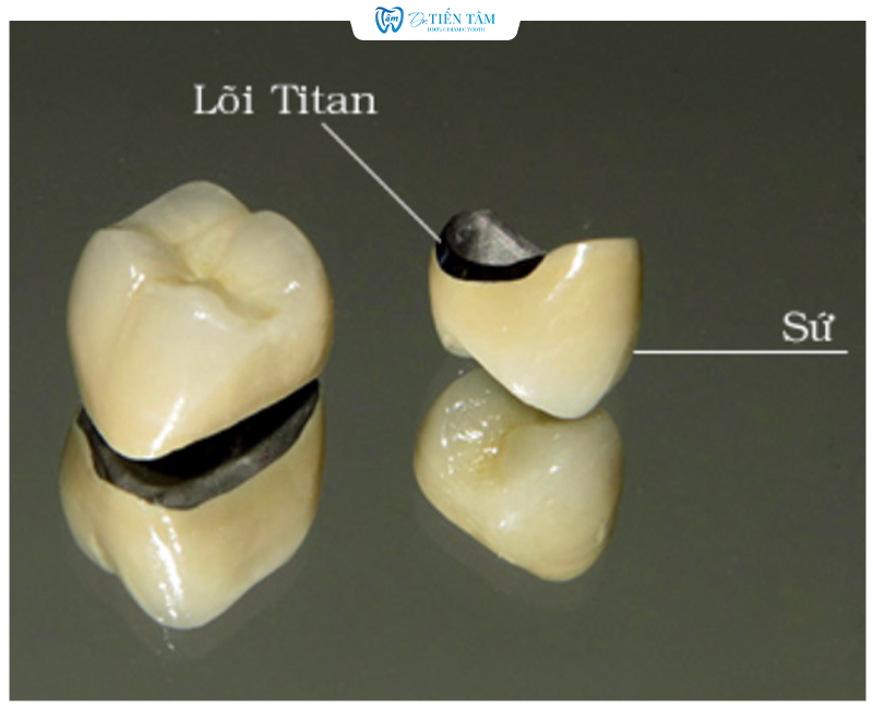 Cấu trúc răng sứ