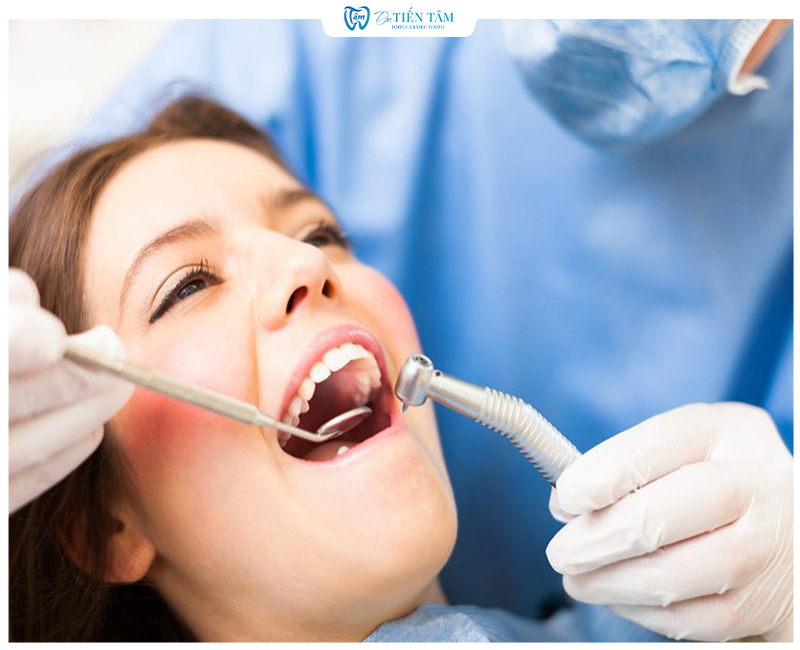 Quy trình lấy tuỷ răng chuẩn Y khoa khi bọc răng sứ tại Fine Dental