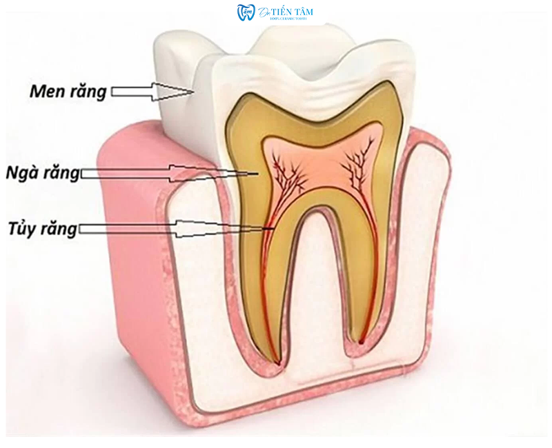 Tuỷ răng là gì?